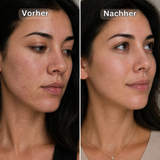 SkinRepair Creme